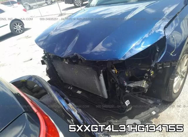5XXGT4L31HG134755_6.webp