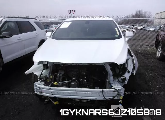 1GYKNARS6JZ105878_6.webp