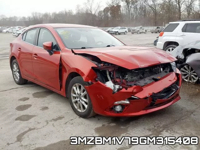 3MZBM1V79GM315408