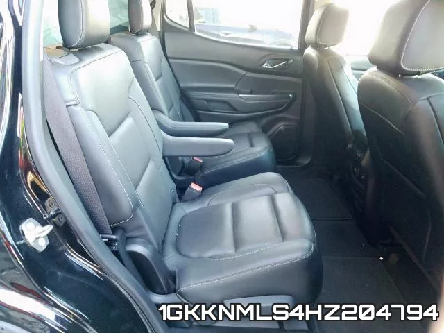 1GKKNMLS4HZ204794