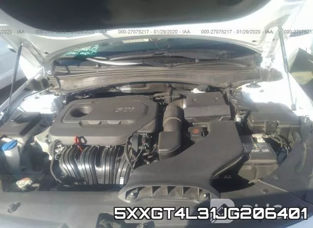 5XXGT4L31JG206401_10.webp