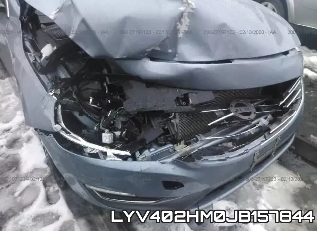 LYV402HM0JB157844_6.webp