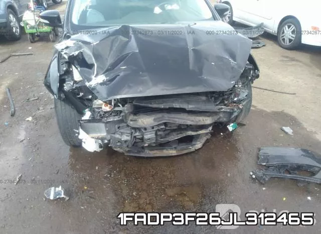 1FADP3F26JL312465