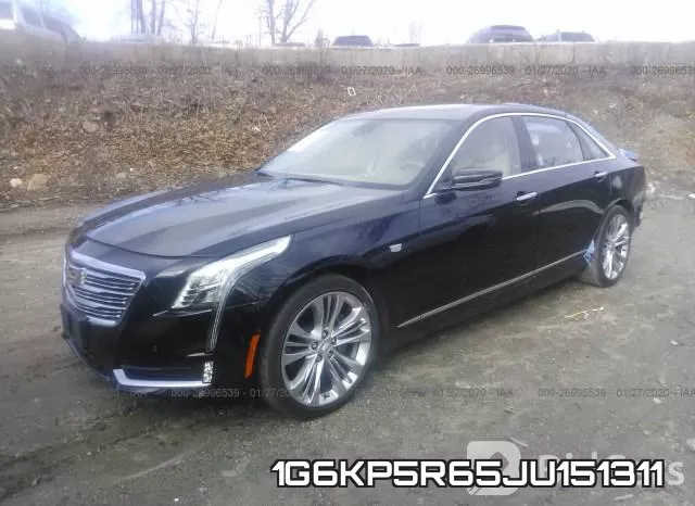 1G6KP5R65JU151311_2.webp