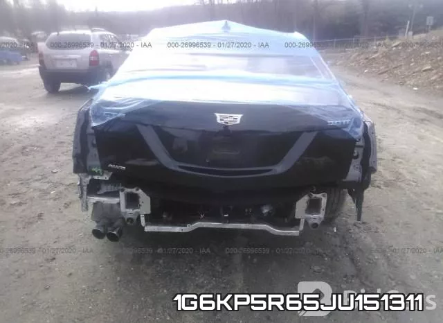 1G6KP5R65JU151311