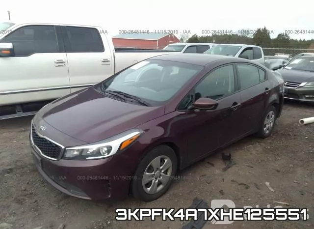 3KPFK4A7XHE125551_2.webp