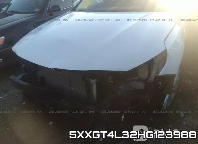 5XXGT4L32HG123988_6.webp