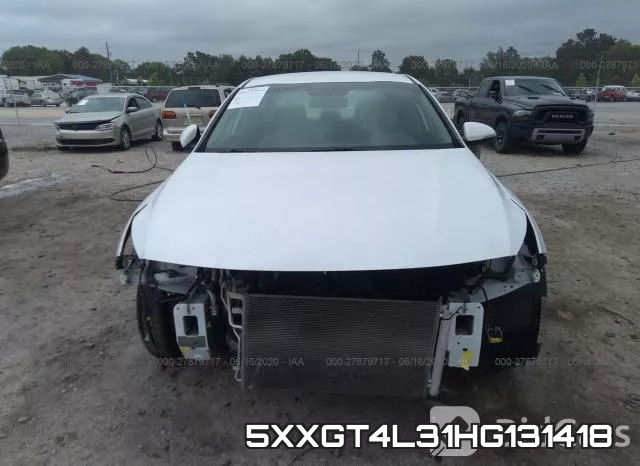 5XXGT4L31HG131418_6.webp