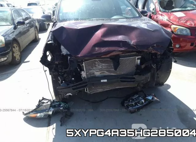 5XYPG4A35HG285004