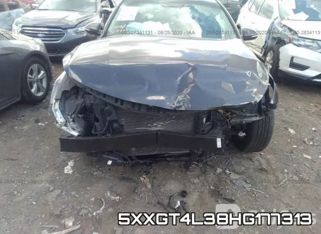 5XXGT4L38HG177313_6.webp