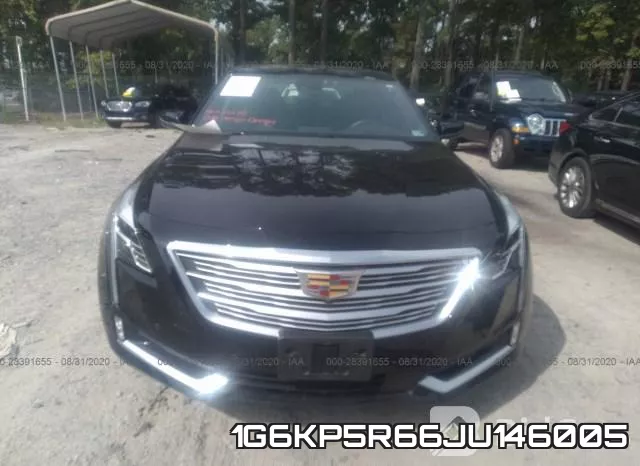 1G6KP5R66JU146005_6.webp