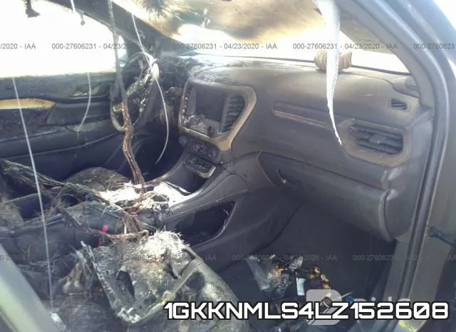 1GKKNMLS4LZ152608_5.webp