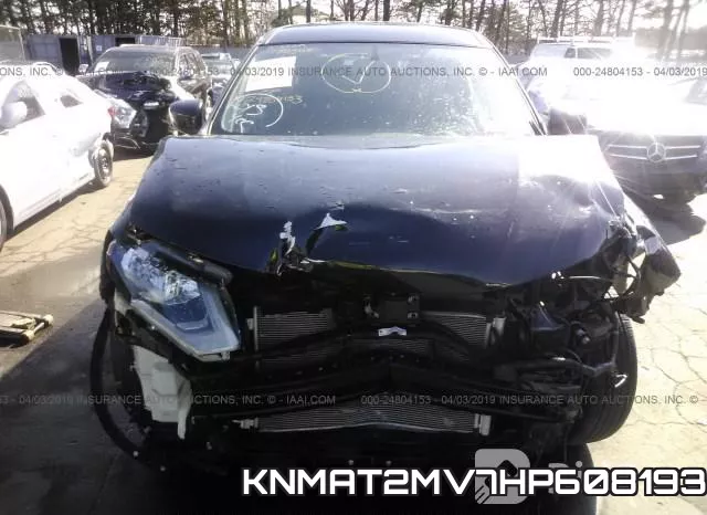 KNMAT2MV7HP608193