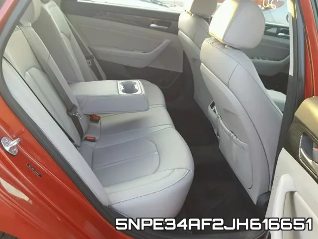 5NPE34AF2JH616651_6.webp