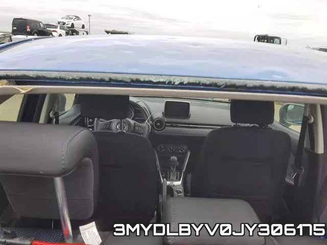 3MYDLBYV0JY306175
