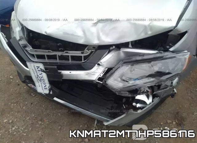 KNMAT2MT7HP586176_6.webp