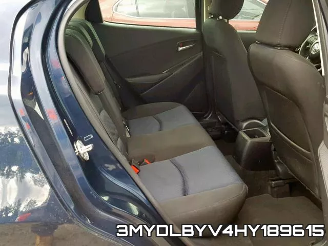 3MYDLBYV4HY189615