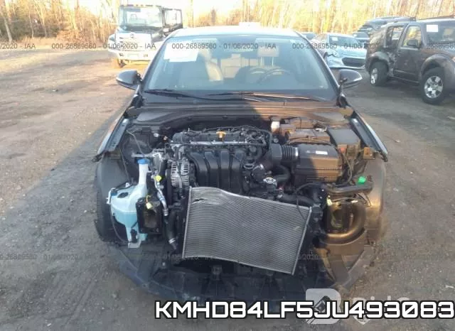 KMHD84LF5JU493083_6.webp
