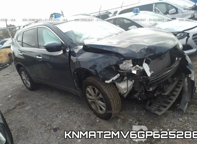 KNMAT2MV6GP625288