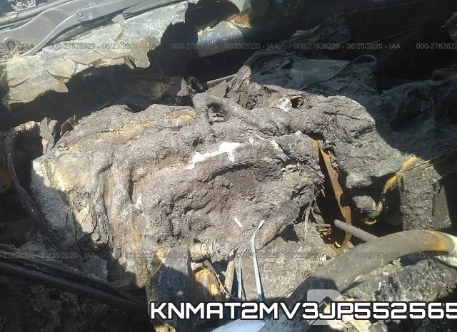 KNMAT2MV3JP552565_7.webp