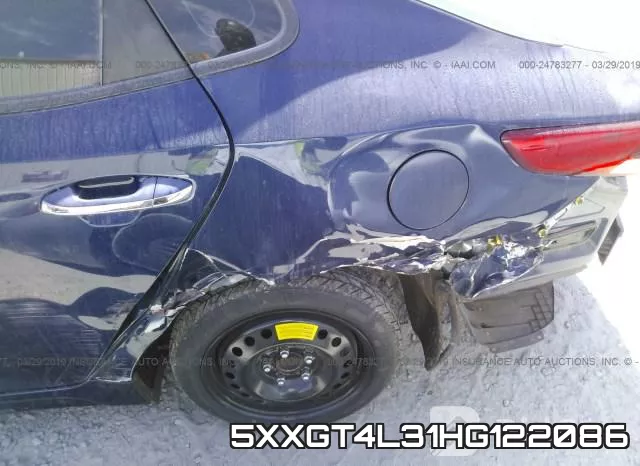 5XXGT4L31HG122086_6.webp