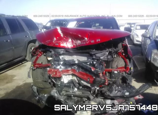 SALYM2RV5JA757448_6.webp