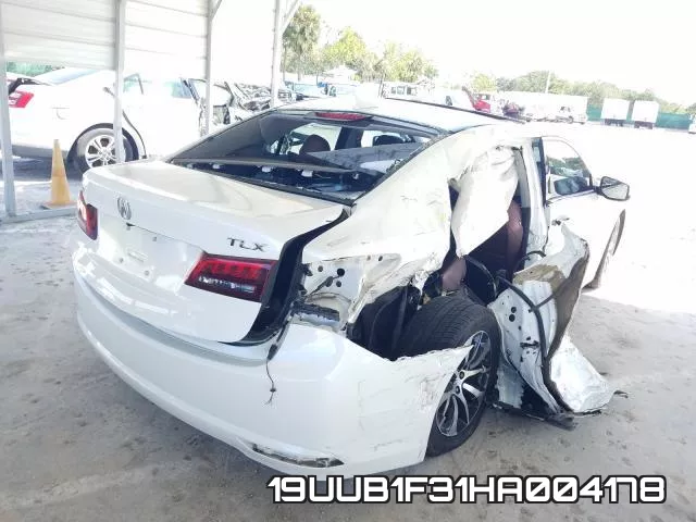 19UUB1F31HA004178_4.webp