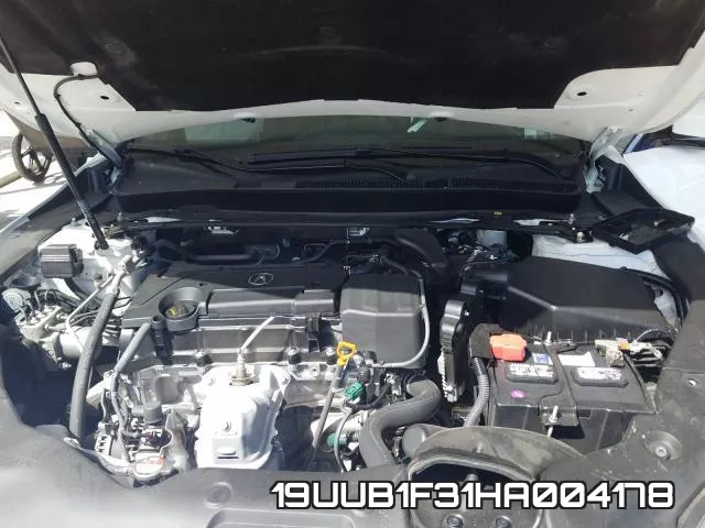 19UUB1F31HA004178_7.webp